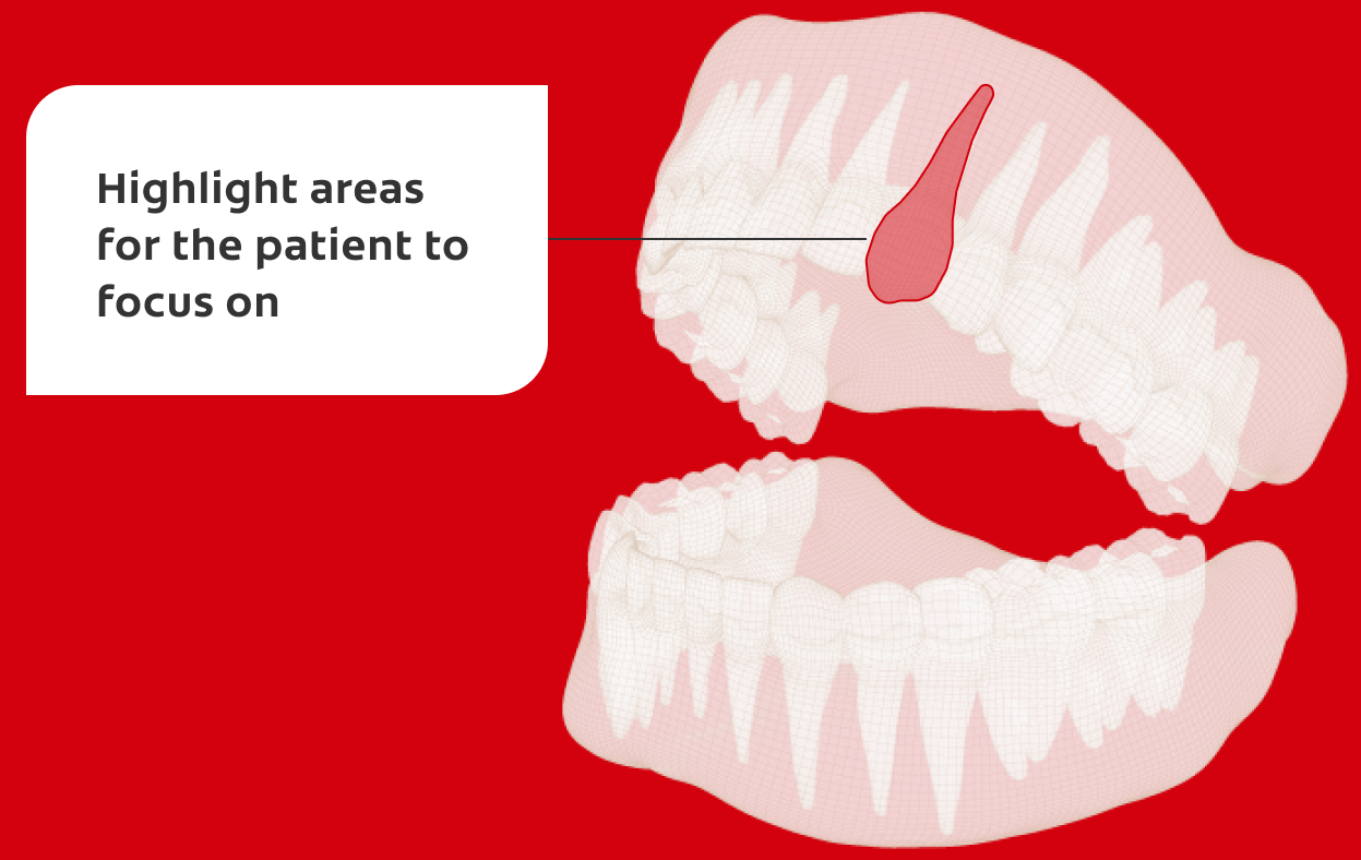 Destaque as áreas mais relevantes para o paciente observar