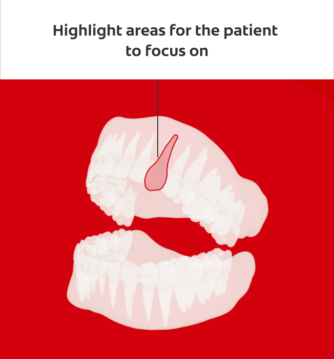 Highlight areas for the patient to focus on