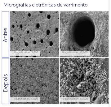 Micrografias ao microscópio eletrônico de varredura.